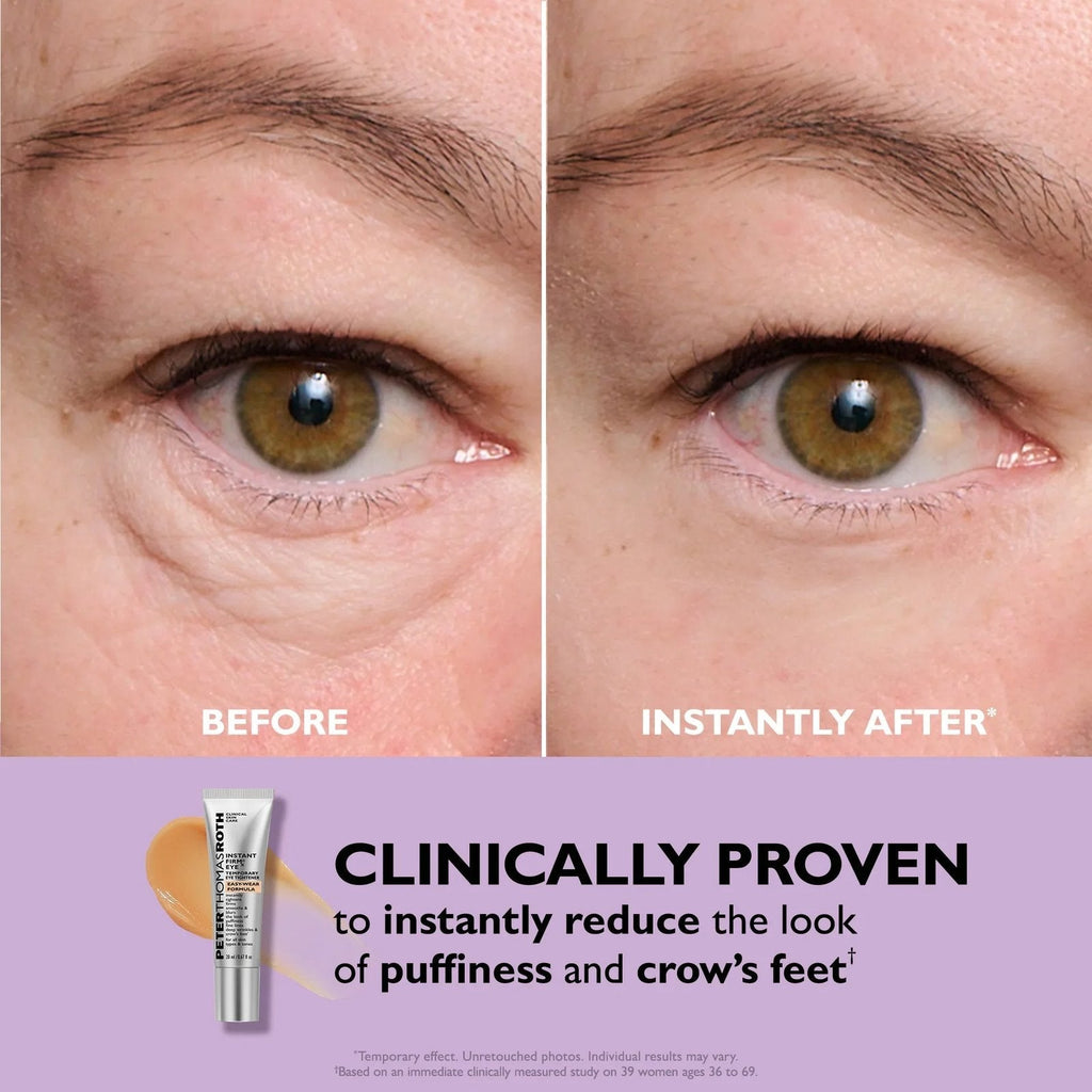 Instant Eye Tightener Primer – Firming Under Eye Serum with Hyaluronic Acid & Vitamin E